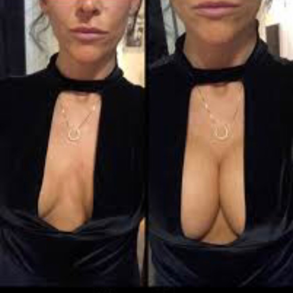 Bras - Picture 4 of 4